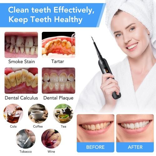 Electric Ultrasonic Teeth Whitener Home Use Dental tools wholesale